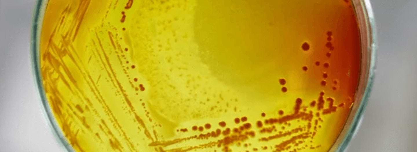 Enfermedades digestivas: formas de presentación y qué tener en cuenta