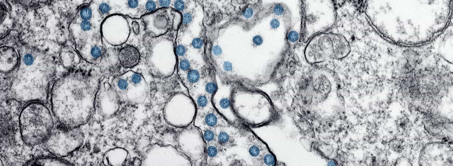Las bacterias en el punto de mira: desde la formación de esporas hasta nuestros criterios de selección