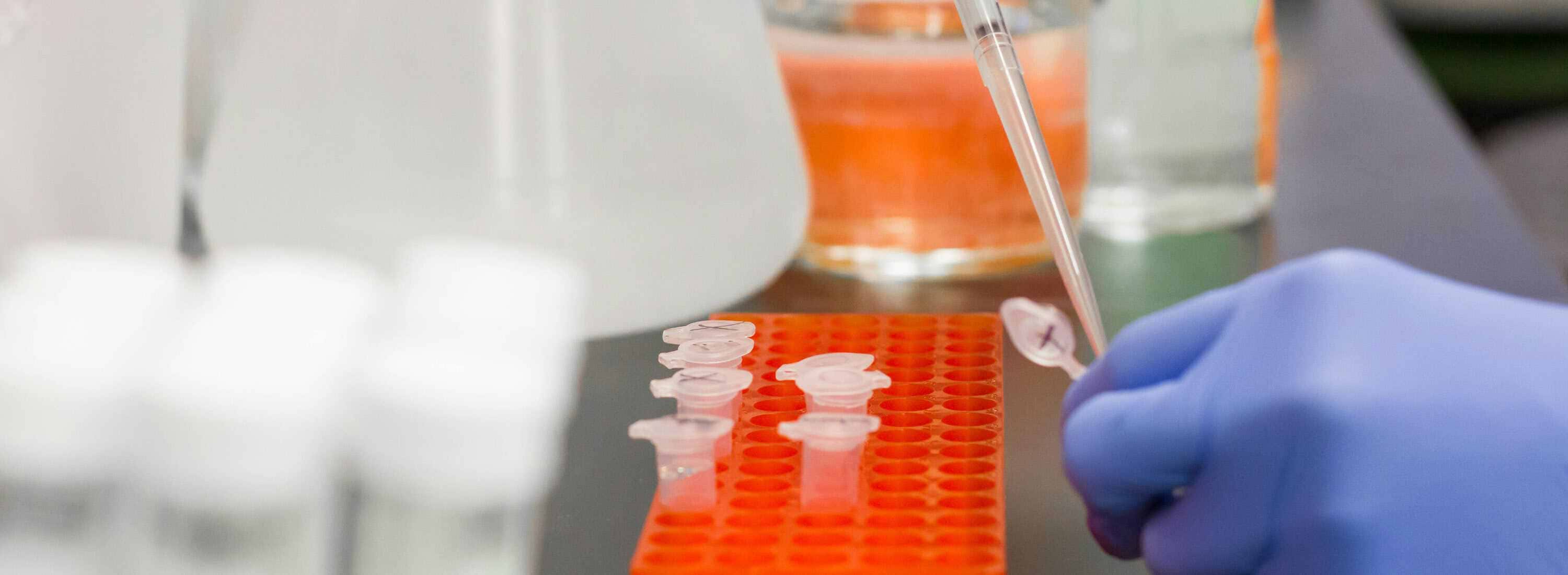 Buenas noticias de la investigación: salud intestinal y riesgo de infección