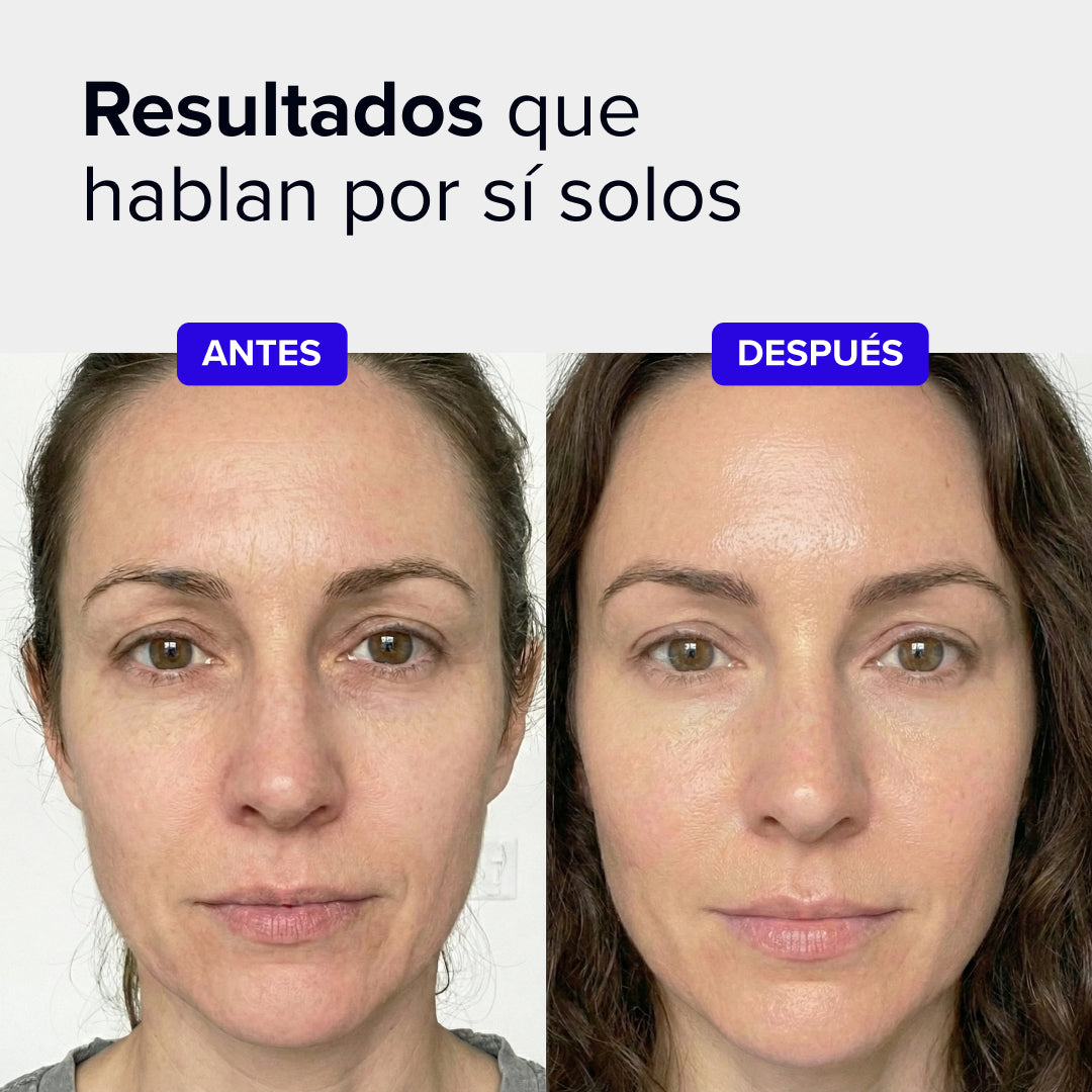 Beautybacs