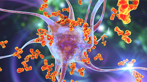 microscopic organism