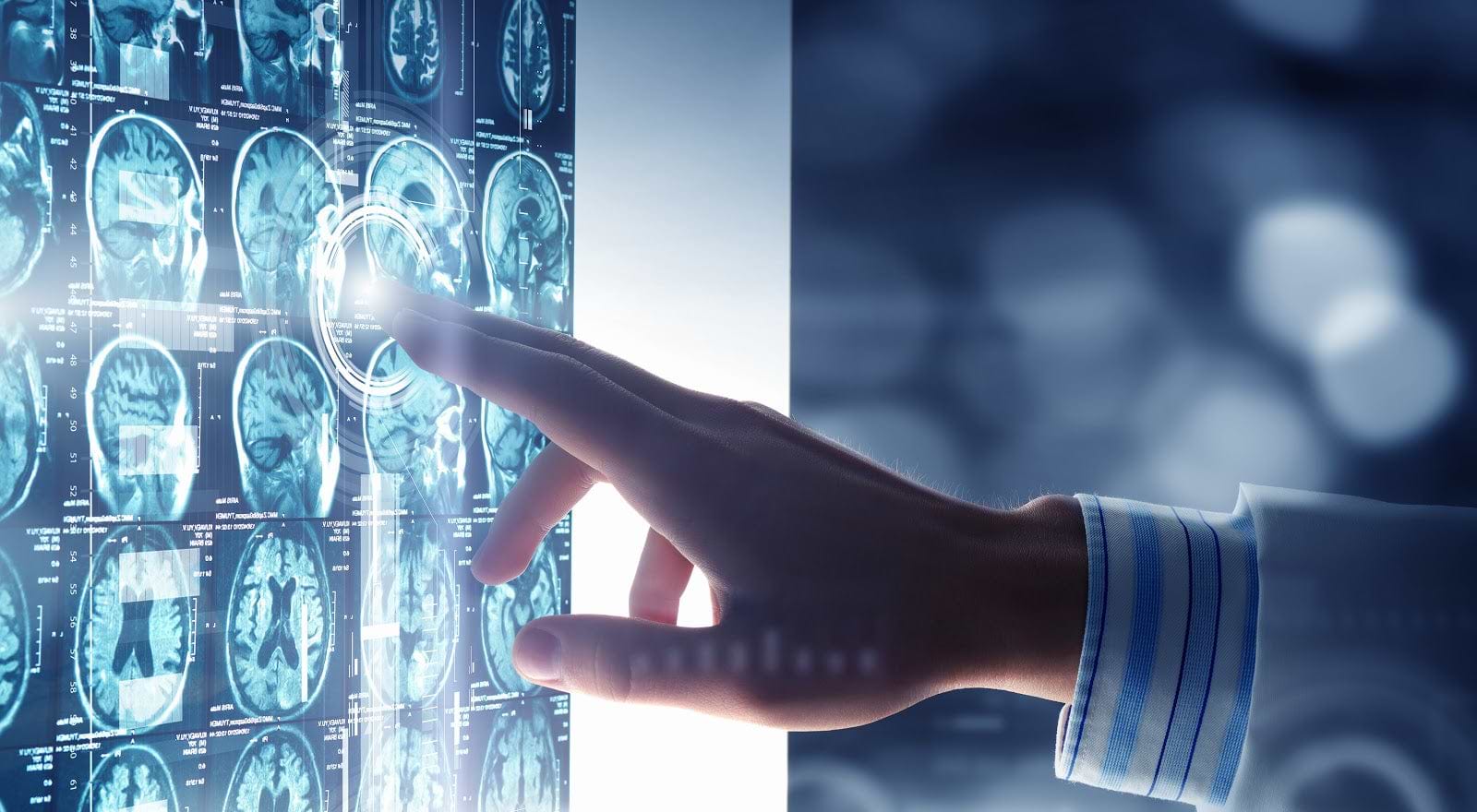 Benefits of collagen: Close-up of brain scans