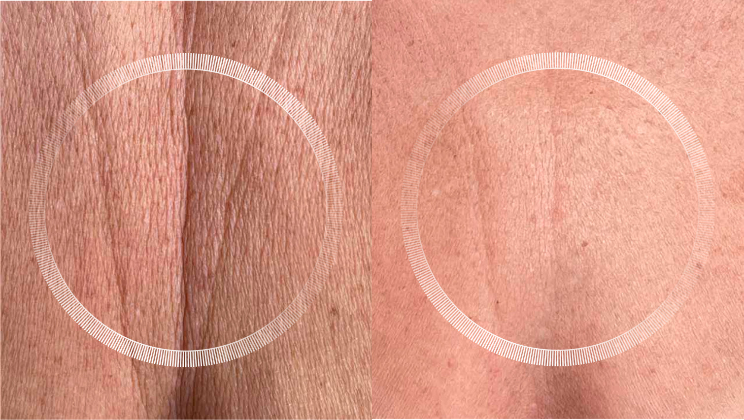 pigmentation on skin