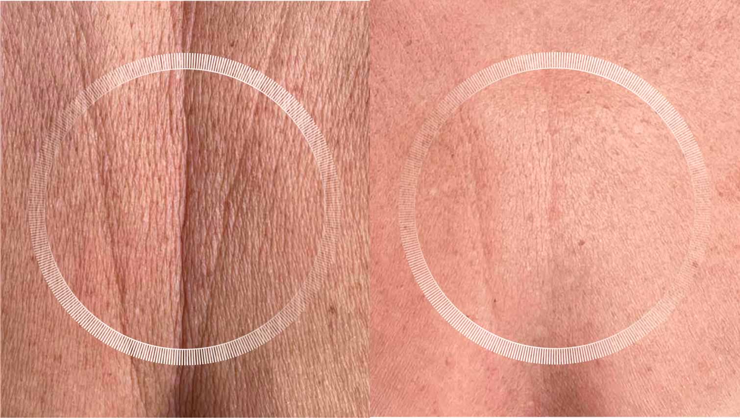 pigmentation on skin