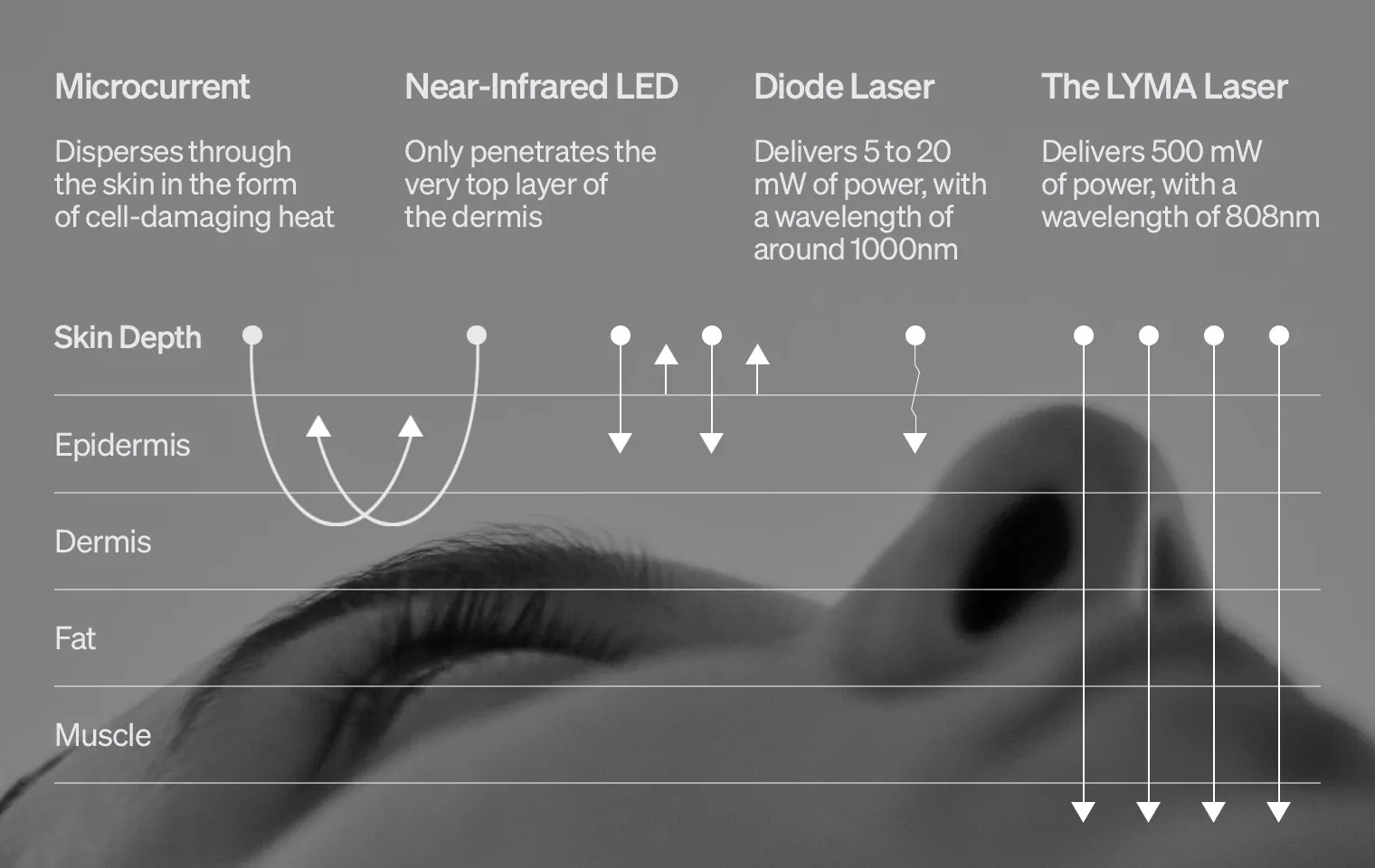 Comparison of LYMA Laser and other technologies