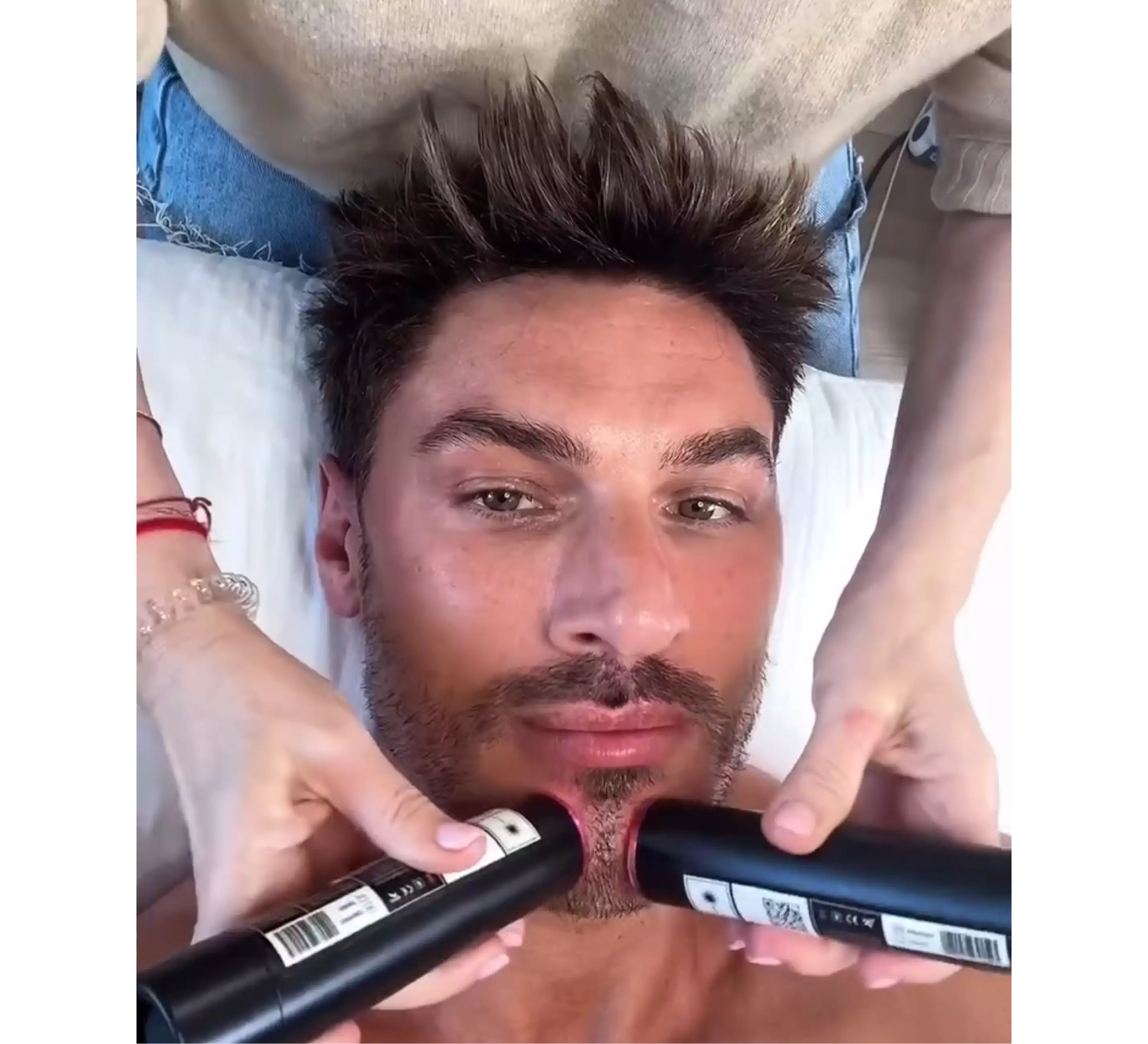 Celebrity facial treatment using LYMA Laser duo