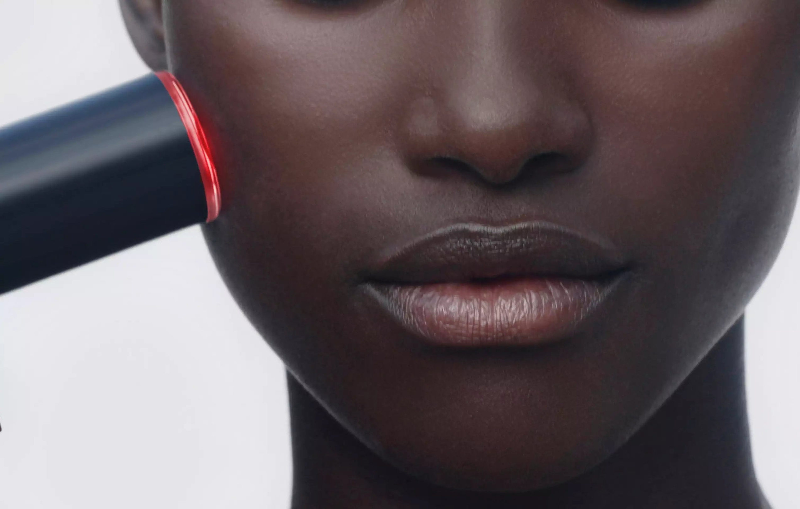 LYMA Laser treatment on darker skin cheek area