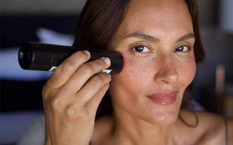 pigmentation photo
