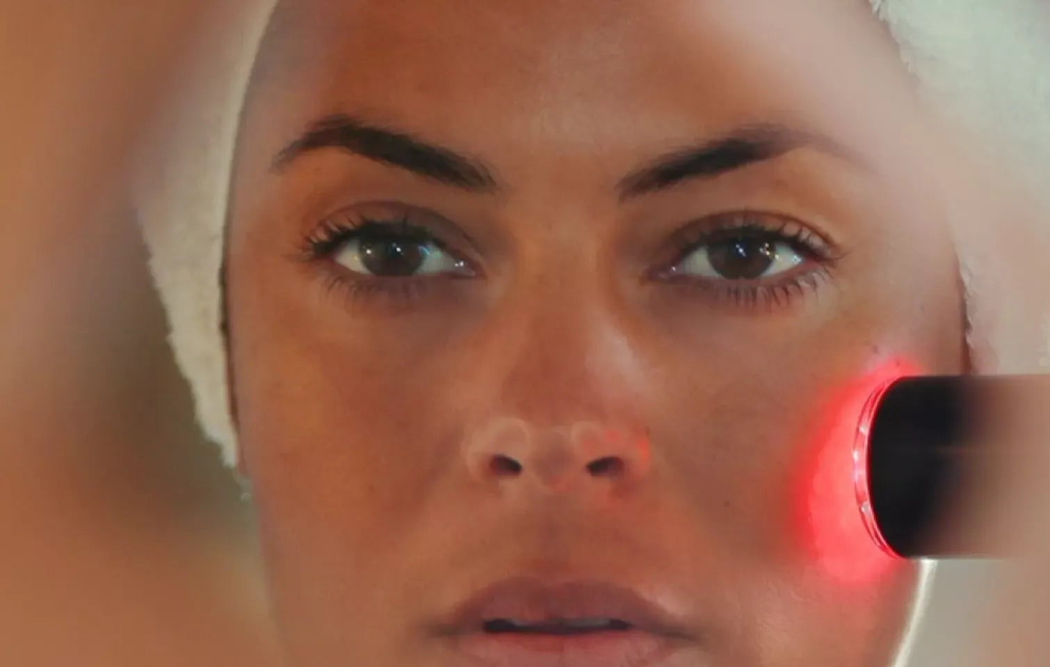 Close-up LYMA Laser treatment for forehead wrinkles