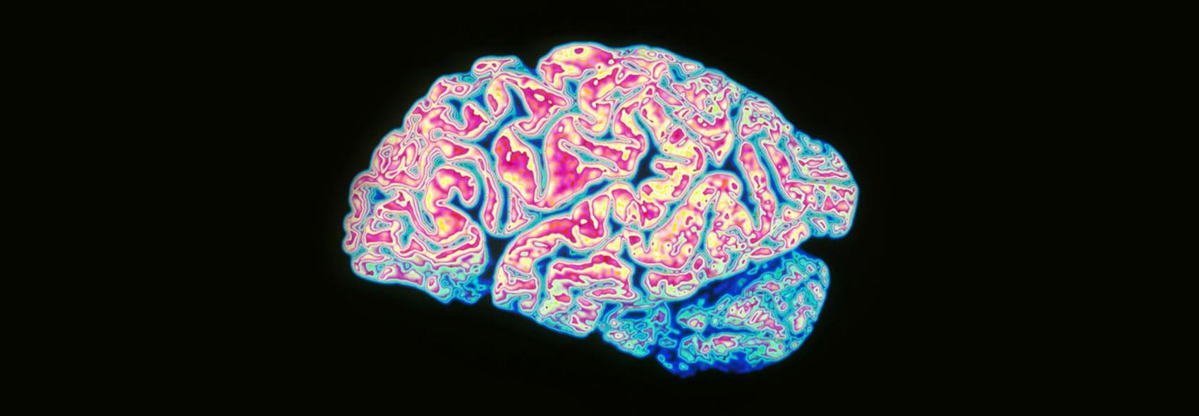 Brain health supplement
