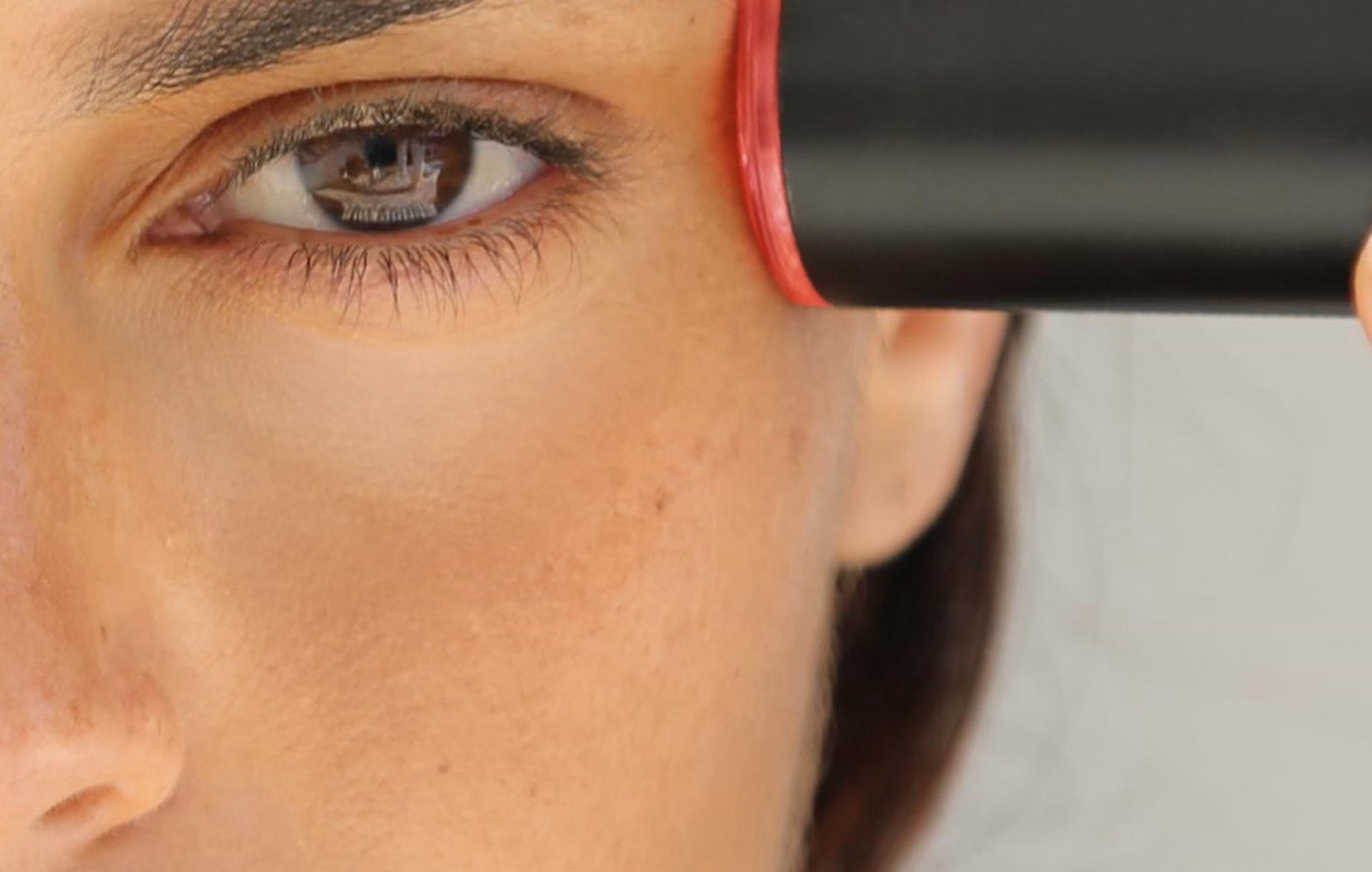 Close-up of LYMA Laser face treatment for anti-aging results