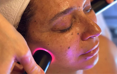 LYMA Laser used by celebrity glam squads at the Golden Globes LYMA Laser used by celebrity glam squads at the Golden Globes