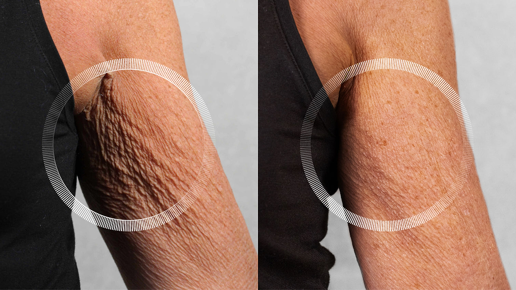 “Never in my wildest dreams would I have thought my arms could look like this”