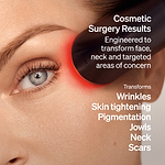 LYMA Laser - LYMA's breakthrough cold laser technology. Engineered to make you look younger.