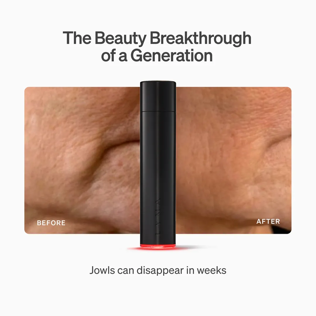 LYMA Laser - LYMA's breakthrough cold laser technology. Engineered to make you look younger.