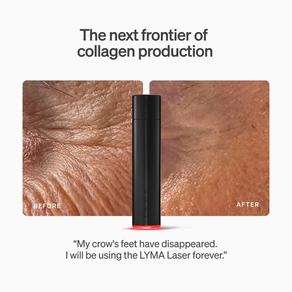 LYMA Laser