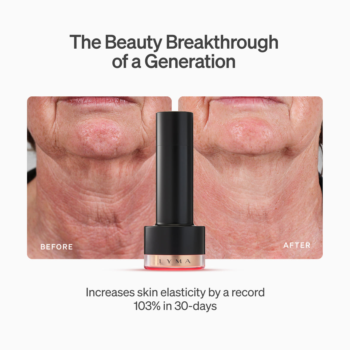 LYMA Laser PRO - LYMA's breakthrough cold laser technology. Younger skin. Bigger lens. Faster results.