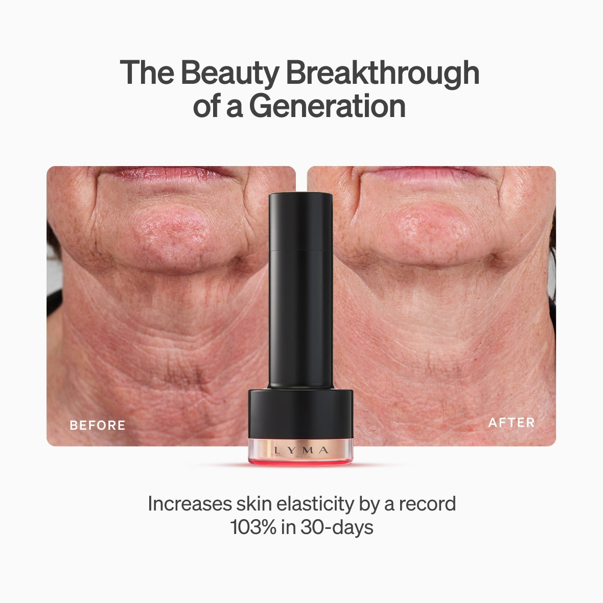 LYMA Laser PRO - LYMA's breakthrough cold laser technology. Younger skin. Bigger lens. Faster results.