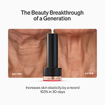 LYMA Laser PRO - LYMA's breakthrough cold laser technology. Younger skin. Bigger lens. Faster results.