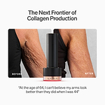 LYMA PRO Youth System - Tighter jawline. Fewer wrinkles. Firmer neck. This is what happens when three technologies are engineered as one anti-ageing system.