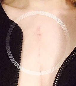 After image