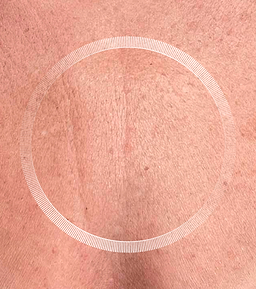After image