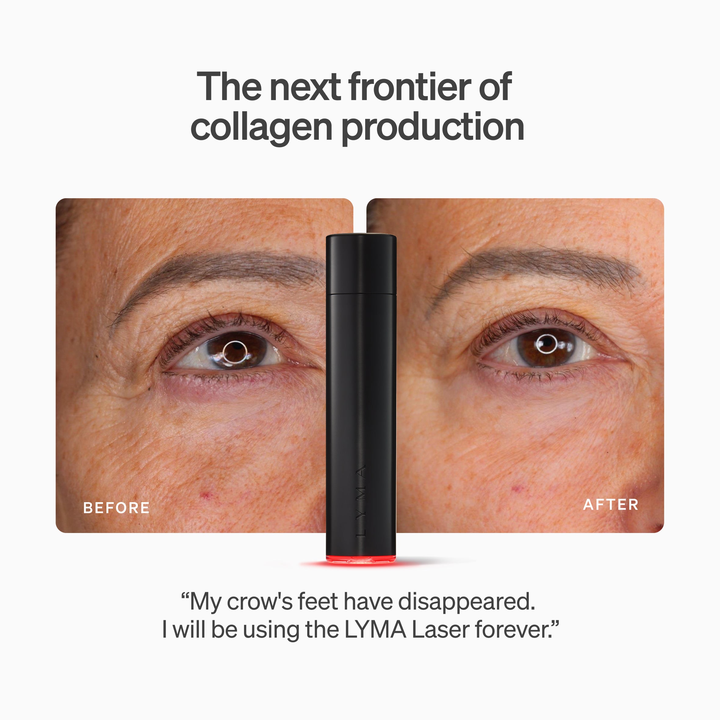 LYMA Lasers. The Power of Proof