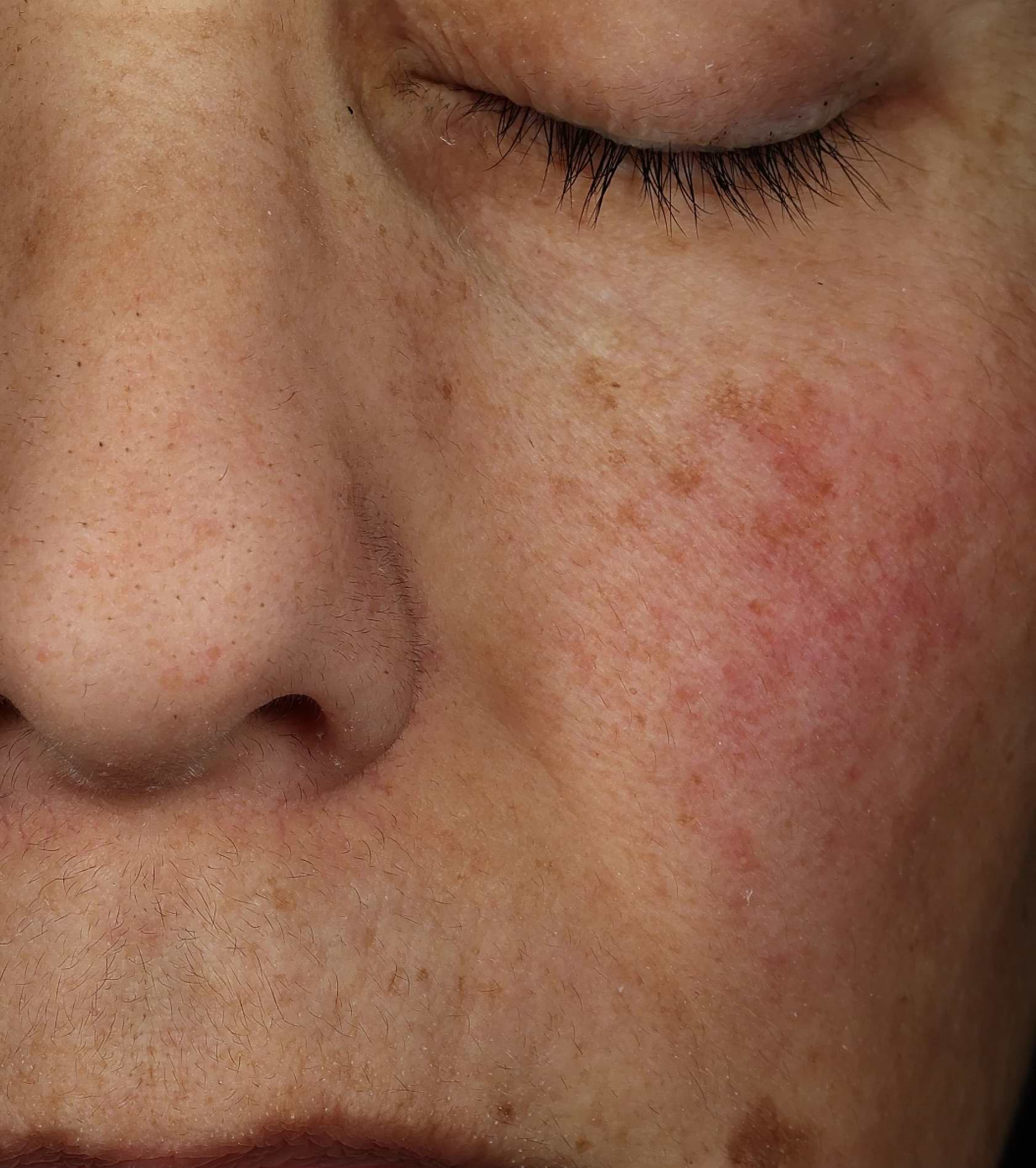 Day 28