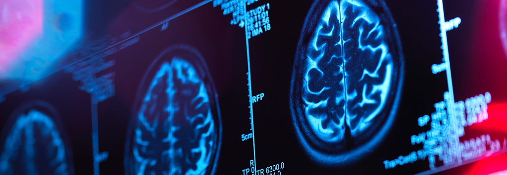 The Gut-Brain Connection: What Your Microbiome Is Doing to Your Mental Health