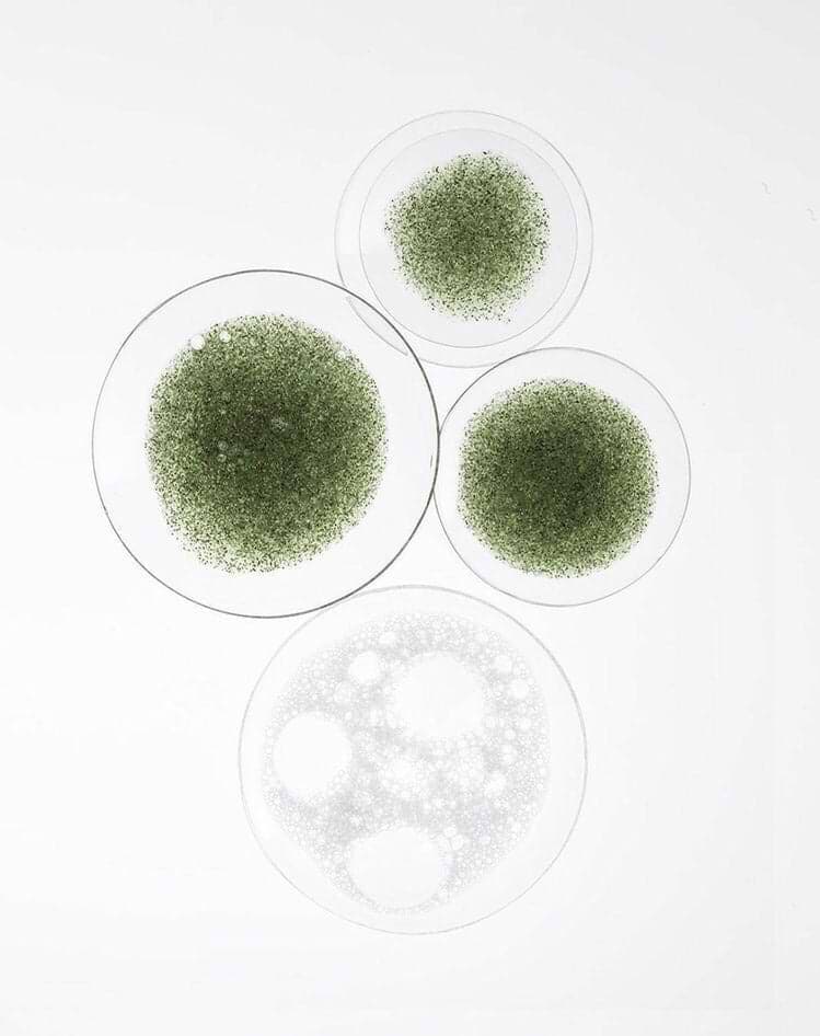 The GLP-1 Paradox: Why the Gut Still Isn't Part of the Conversation