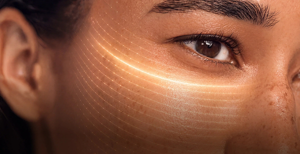 Laser Treatment for Pigmentation: Types, Costs and Risks