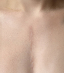After image