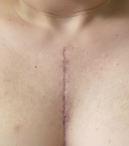 Before image