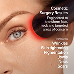 The LYMA Laser - LYMA's breakthrough cold laser technology. Engineered to make you look younger.