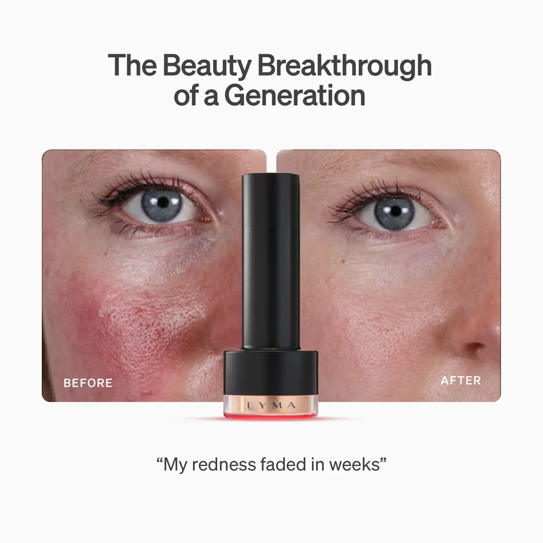 LYMA Laser PRO - LYMA's breakthrough cold laser technology. Younger skin. Bigger lens. Faster results.