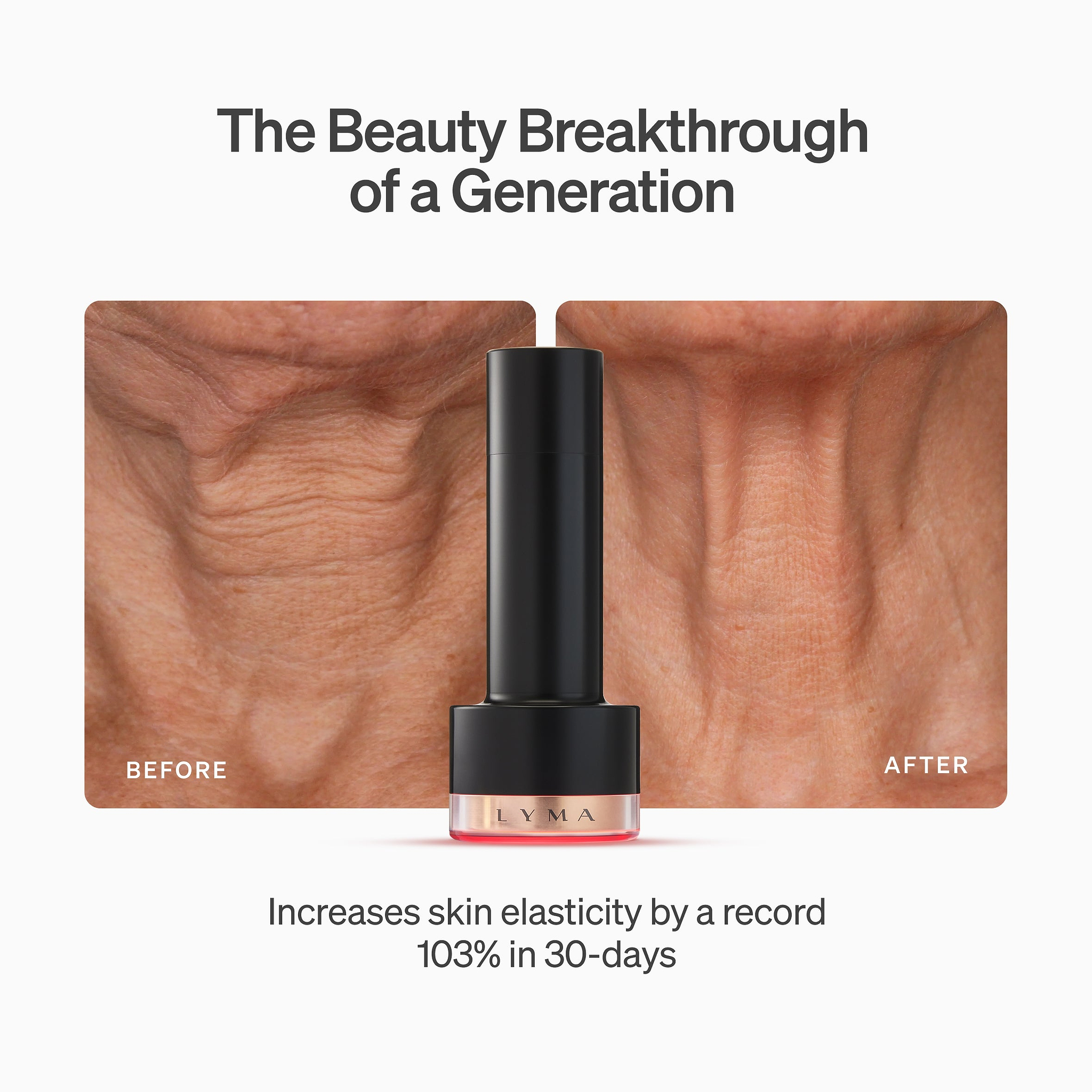 LYMA Laser PRO - LYMA's breakthrough cold laser technology. Younger skin. Bigger lens. Faster results.