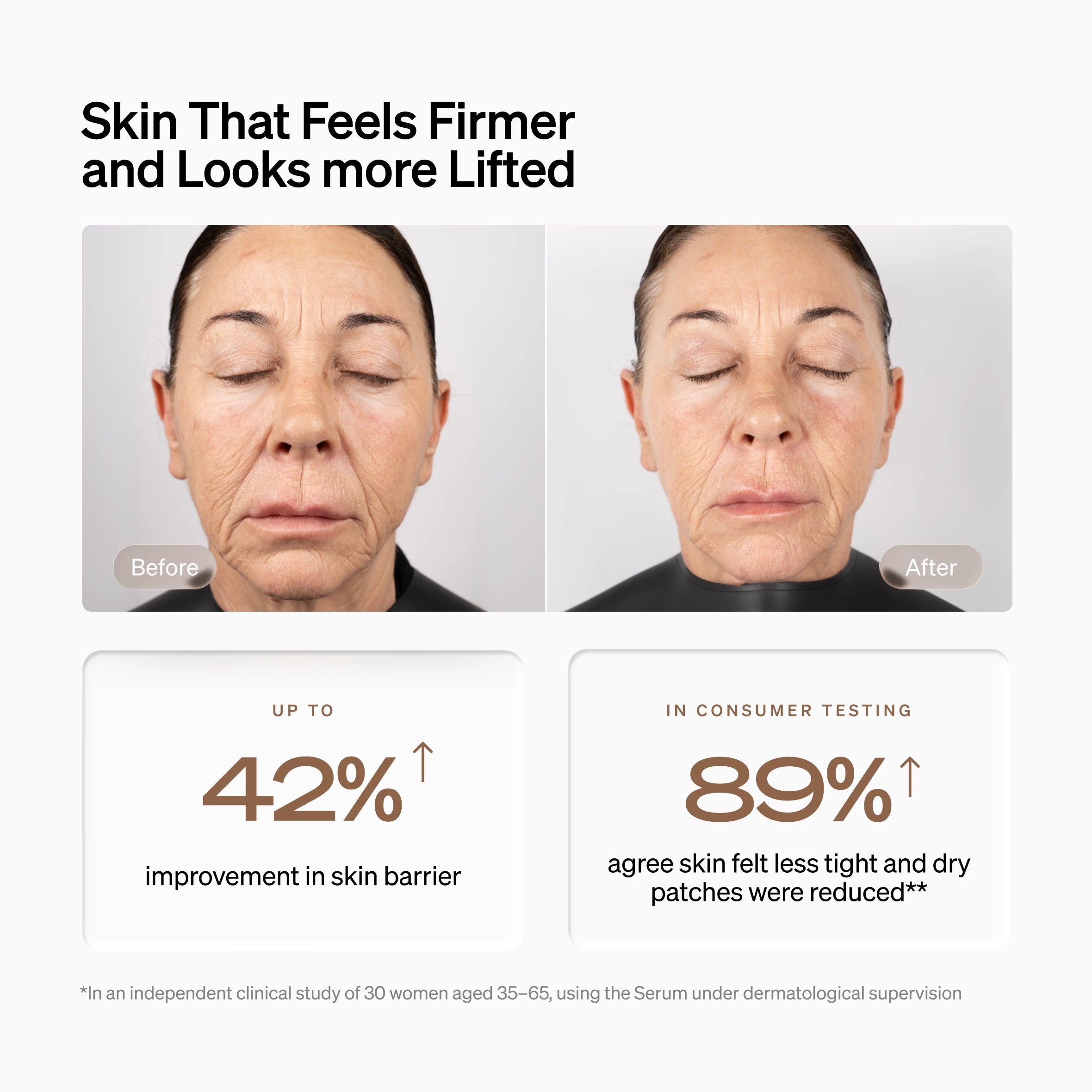 LYMA Power Youth Serum Refill - High-performance biotech serum. Breakthrough hydration that works across the wider signs of aging for plumper, calmer, more even-looking skin in 28 days. 