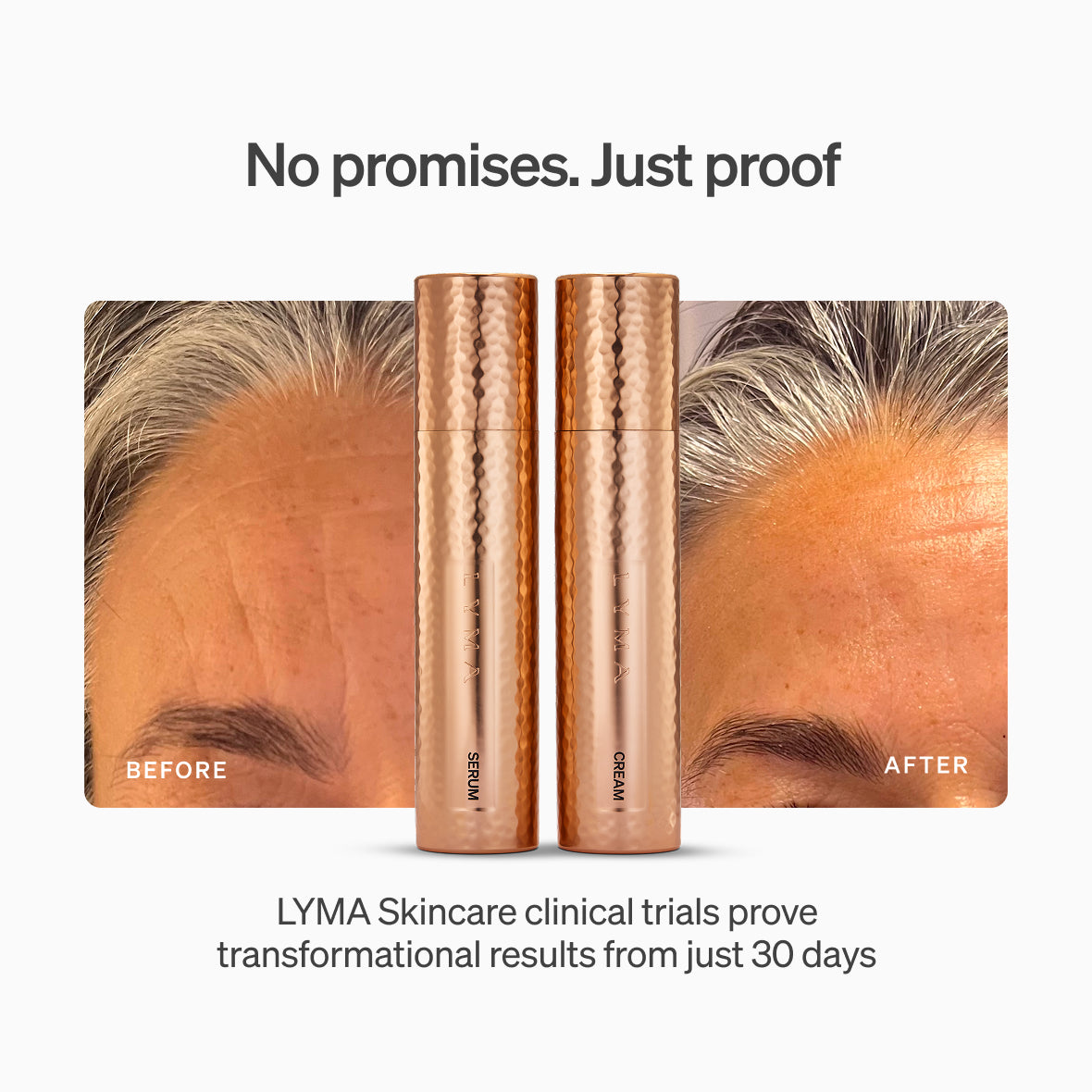 The LYMA PRO Youth System Longevity Edition - Tighter jawline. Fewer wrinkles. Firmer neck. This is what happens when three technologies are engineered as one anti-aging system.