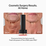 The LYMA PRO Youth System Longevity Edition - Tighter jawline. Fewer wrinkles. Firmer neck. This is what happens when three technologies are engineered as one anti-aging system.