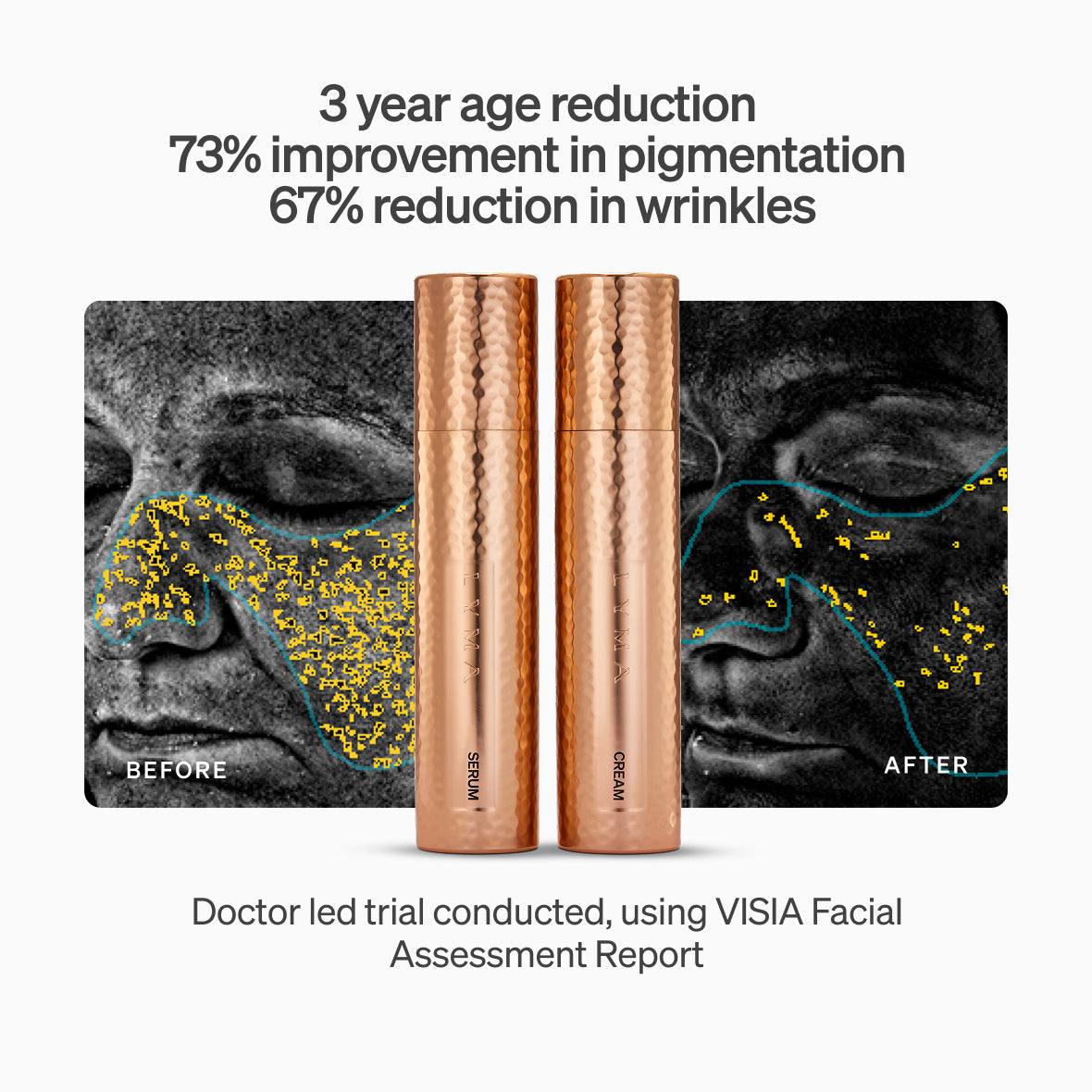 The LYMA PRO Youth System Longevity Edition - Tighter jawline. Fewer wrinkles. Firmer neck. This is what happens when three technologies are engineered as one anti-aging system.