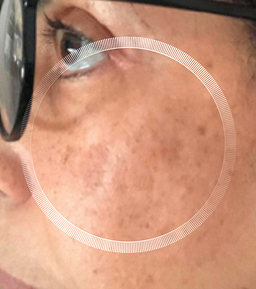 After image
