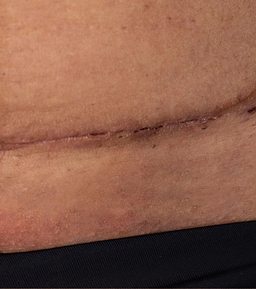 Before image