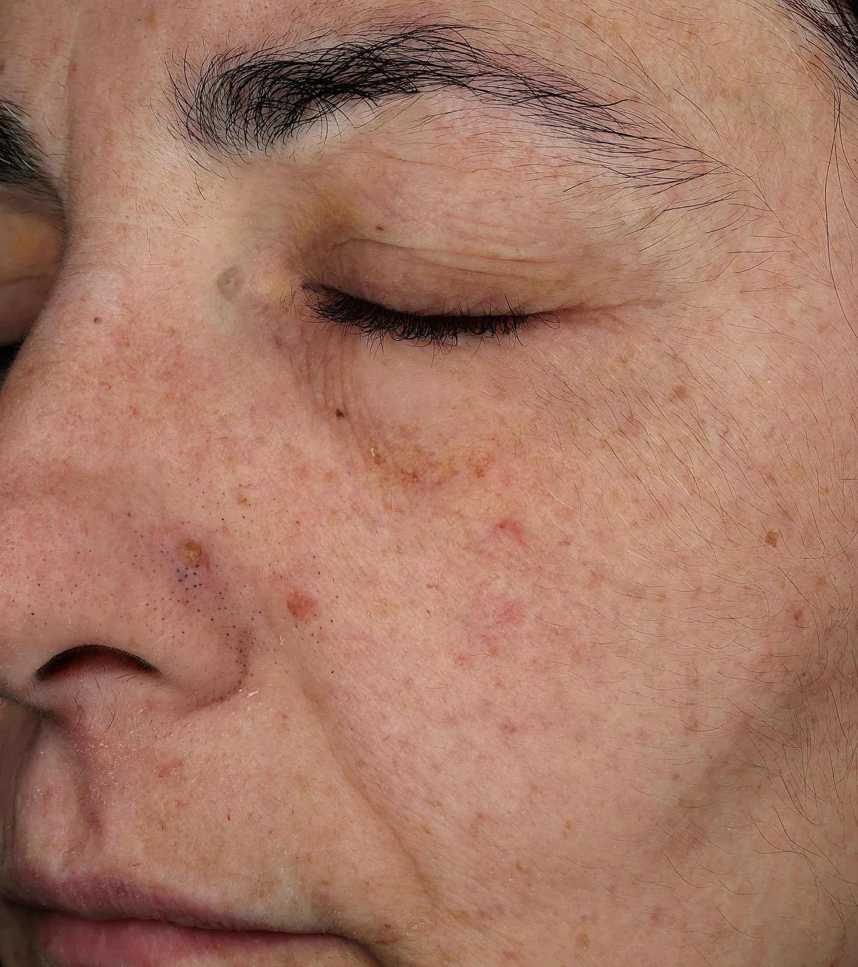 Day 1