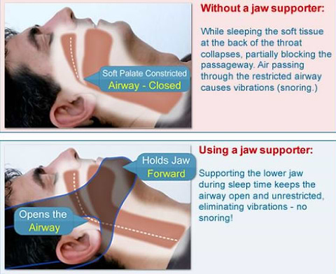 sleeping while snoring