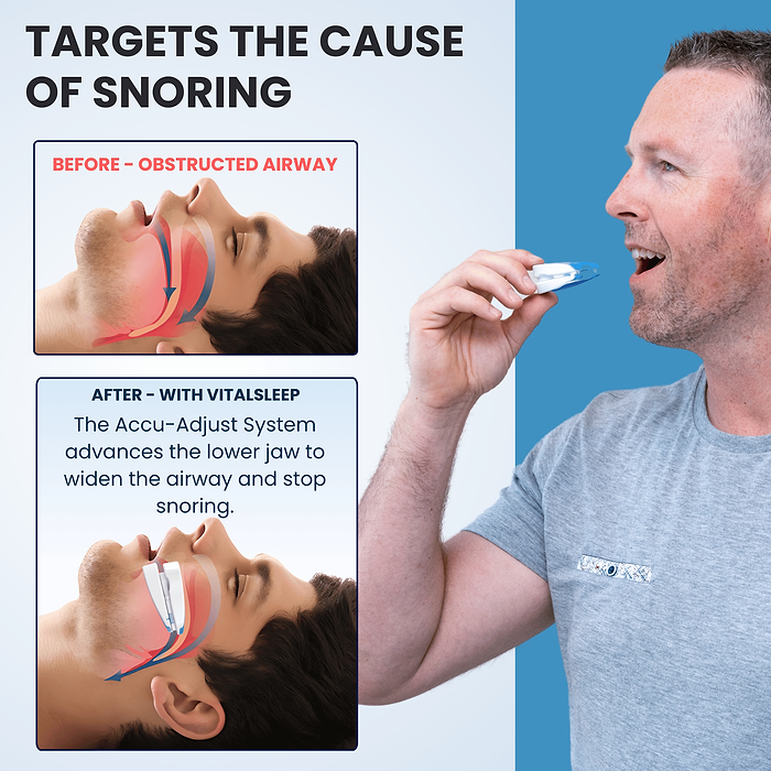 A man holding the VitalSleep mouthpiece