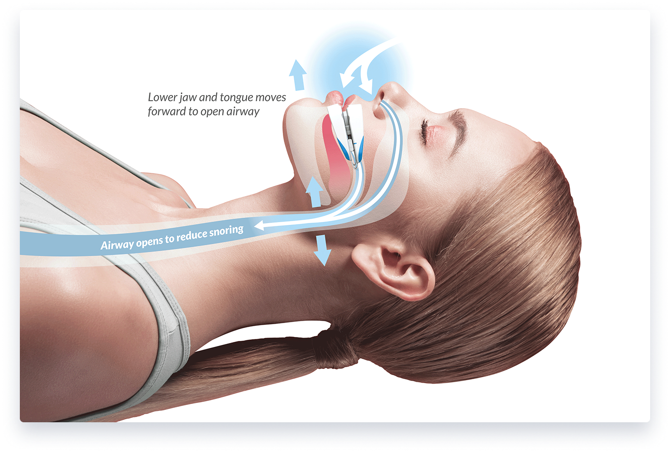 airway flow benefits in woman