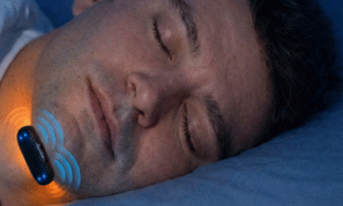 Revitta snoring device