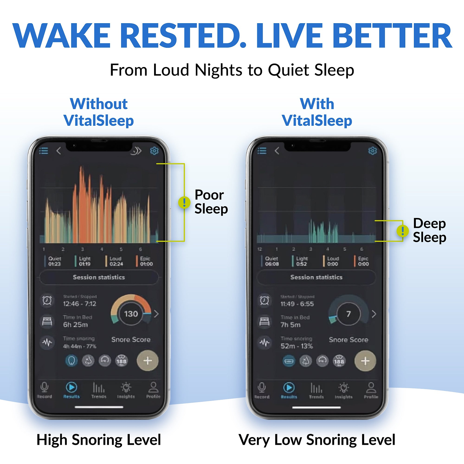 Screenshot from the SnoreLab app showing one user's recorded snoring levels before and after using a snoring mouthpiece