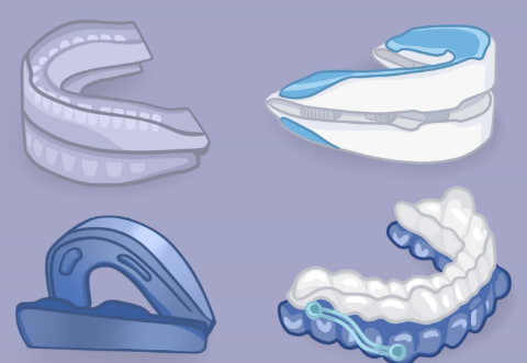 Which Snoring Mouthpiece Works Best? VitalSleep Vs Alternatives