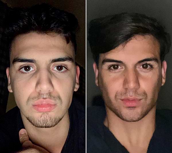 mewing face posture guide for beginners